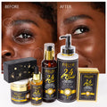 Ailke 24K Ouro Colágeno Creme Articulação Remoção de Manchas Escuras Forte Clareamento Rosto Anti Envelhecimento Conjunto de Cuidados com a Pele