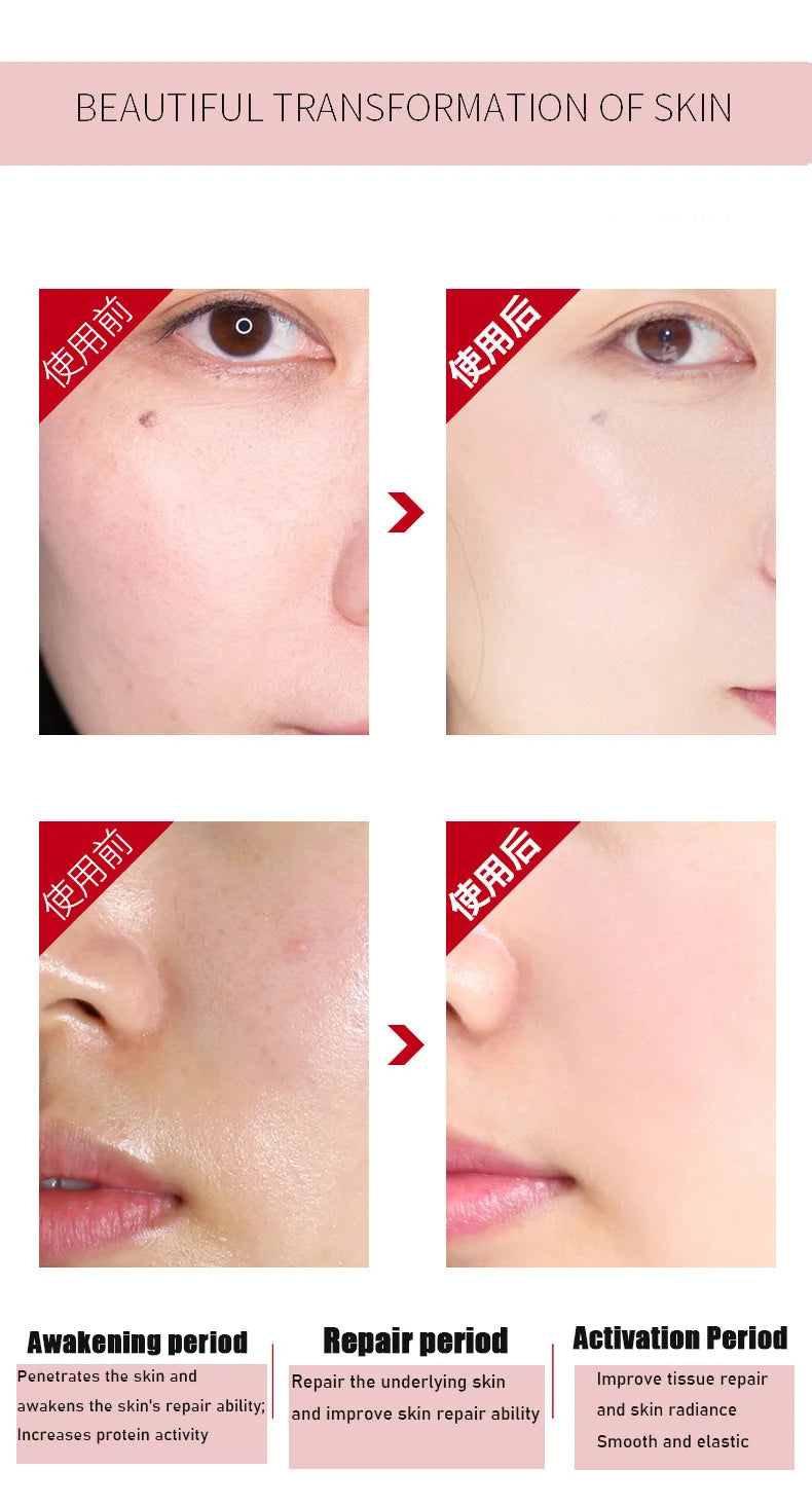 Anti-rugas rosto cuidados com a pele soro conjunto desvanece-se linhas finas hidratante facial brilho anti envelhecimento endurecimento cuidados com a pele essência óleo