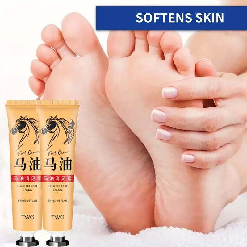 Ma You Qing Creme para pés, Creme hidratante para pés, adequado para pele seca, adequado para cuidados com as mãos e pés para mãos e pés secos