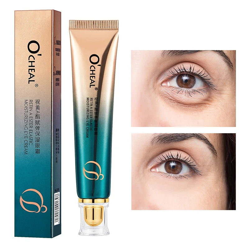 OCHEAL-o creme do olho do Anti-enrugamento, desvanece-se linhas finas, círculos Anti-escuros, soro, remove o saco do olho, puffiness, antienvelhecimento, firmeza, cuidado do olho, OCHEAL