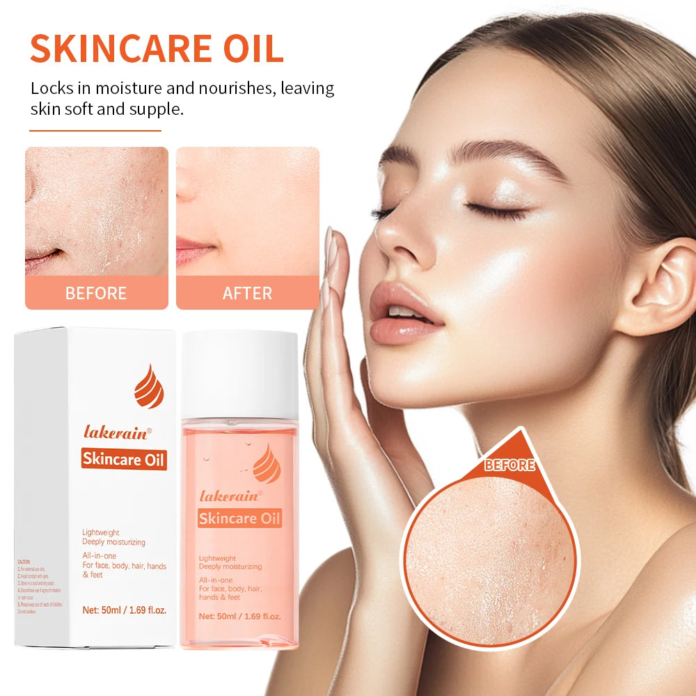 Óleo de cuidados com a pele vitamina e essência de cuidados com a pele para cicatrizes marcas de gravidez facial corpo hidratante óleo para todos os tipos de pele