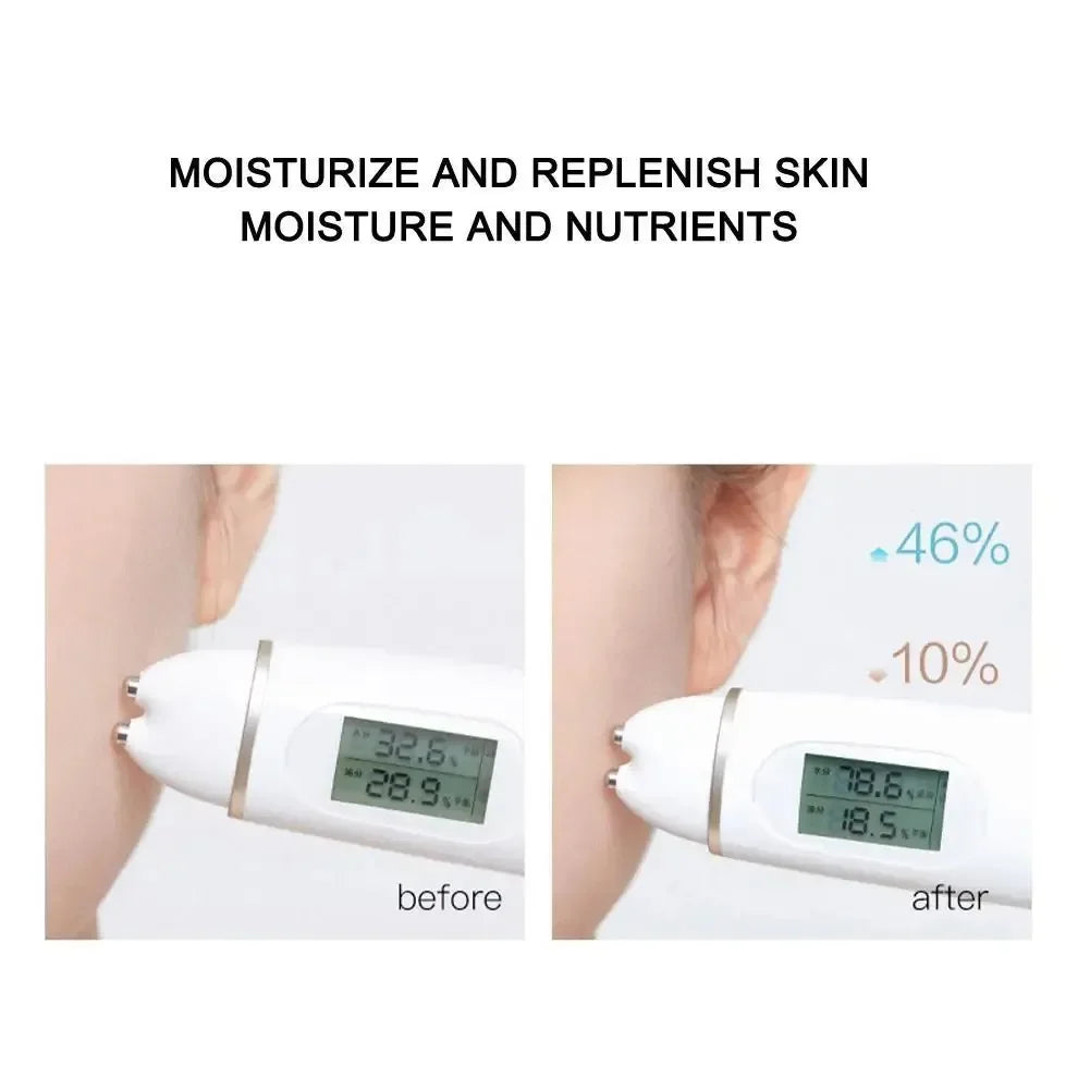 Fios solúveis de lifting facial, colágeno, essência facial, peptídeo de proteína, fio de seda dourada, soro facial para anti-envelhecimento, pele firmadora