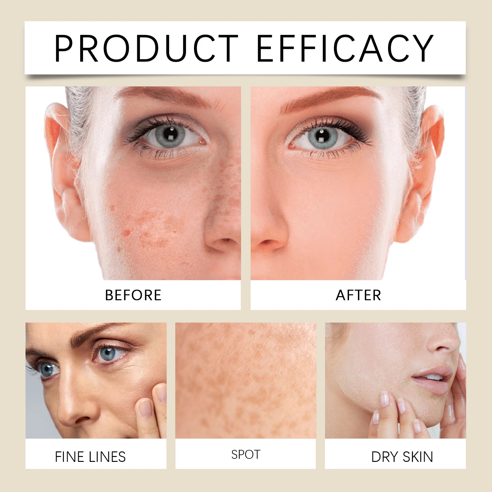 Eelhoe selvagem yam hidratante conjunto de cuidados com a pele 1 conjunto inverno hidratante creme facial loção toner kit barreira protetora não gordurosa