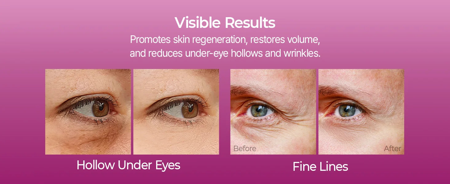 Bálsamo Multifuncional de Cálcio 9g Tudo em Um para Rugas, Volume e Colágeno - Tratamento Facial e Ocular