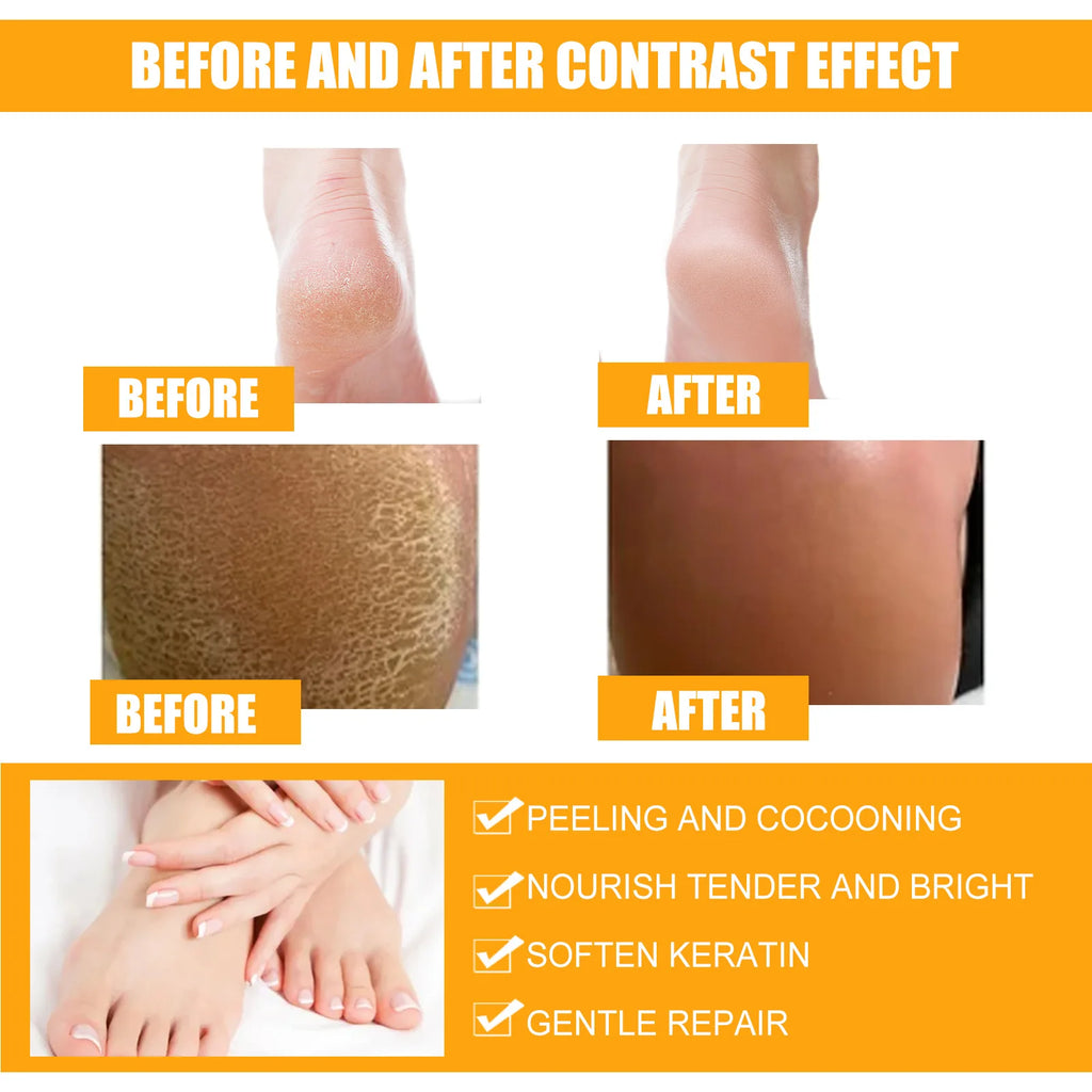 Creme anti-rachadura para pés, spray de ervas para rachaduras no calcanhar, produtos de reparo, esfoliação, remoção de pele morta, suavização, hidratação, cuidados suaves
