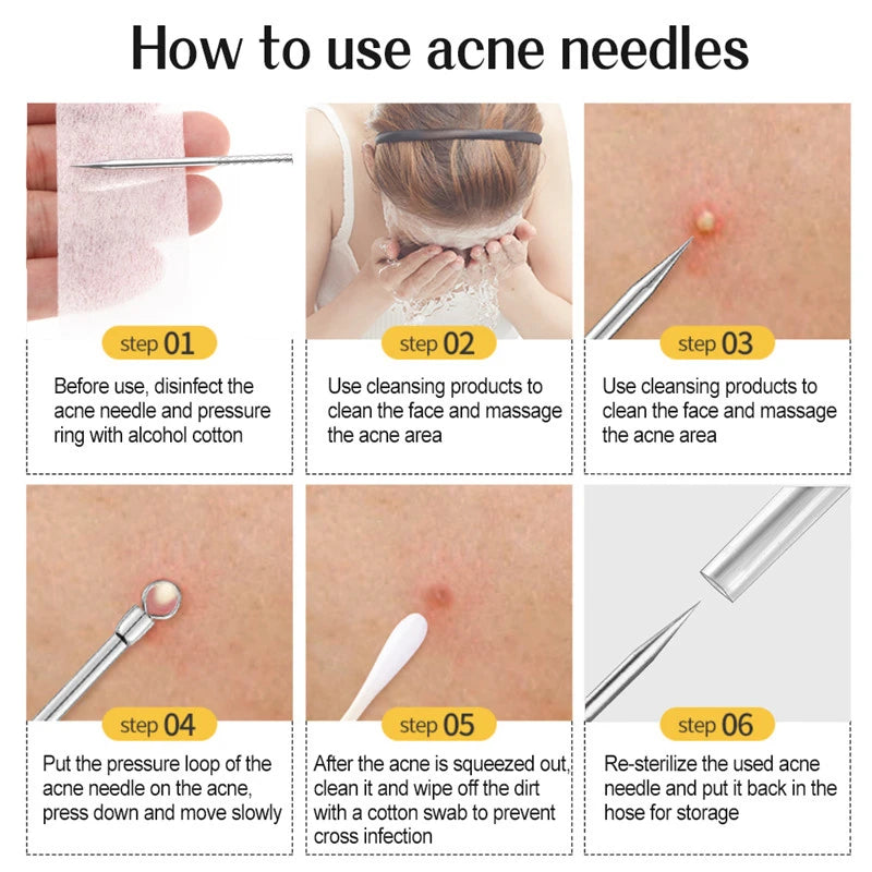 Removedor De Cravos Para Cuidados Com A Pele, Agulha De Acne, Extração De Poros, Black Head Cleaner, Ferramenta De Limpeza, Cell Clamp, 11 Pçs/conjunto