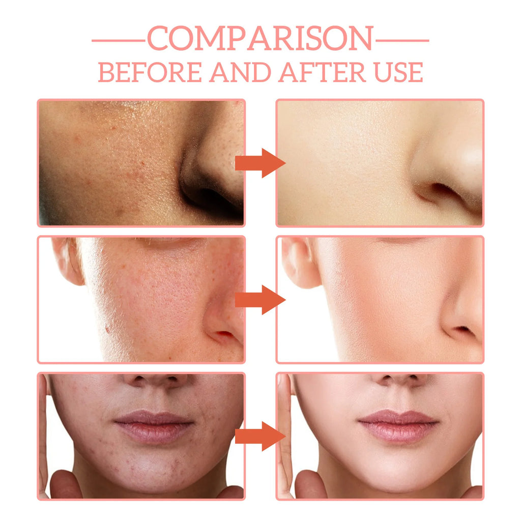 Sérum Facial 5 em 1 para Redução de Linhas Finas, Firmador, Redutor de Manchas e Pigmentação, Hidratante e Firmador da Pele.