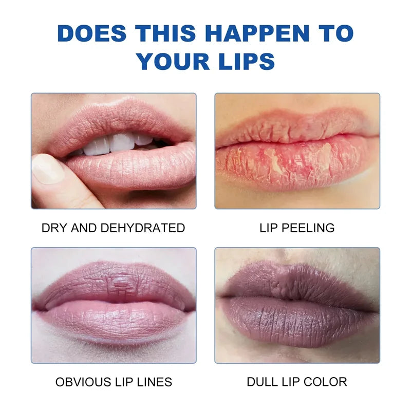 Remover bálsamo labial escuro, clareamento rápido, esfoliante labial rosa, linha labial, hidratante de pele morta, produtos de cuidados coreanos, beleza e saúde