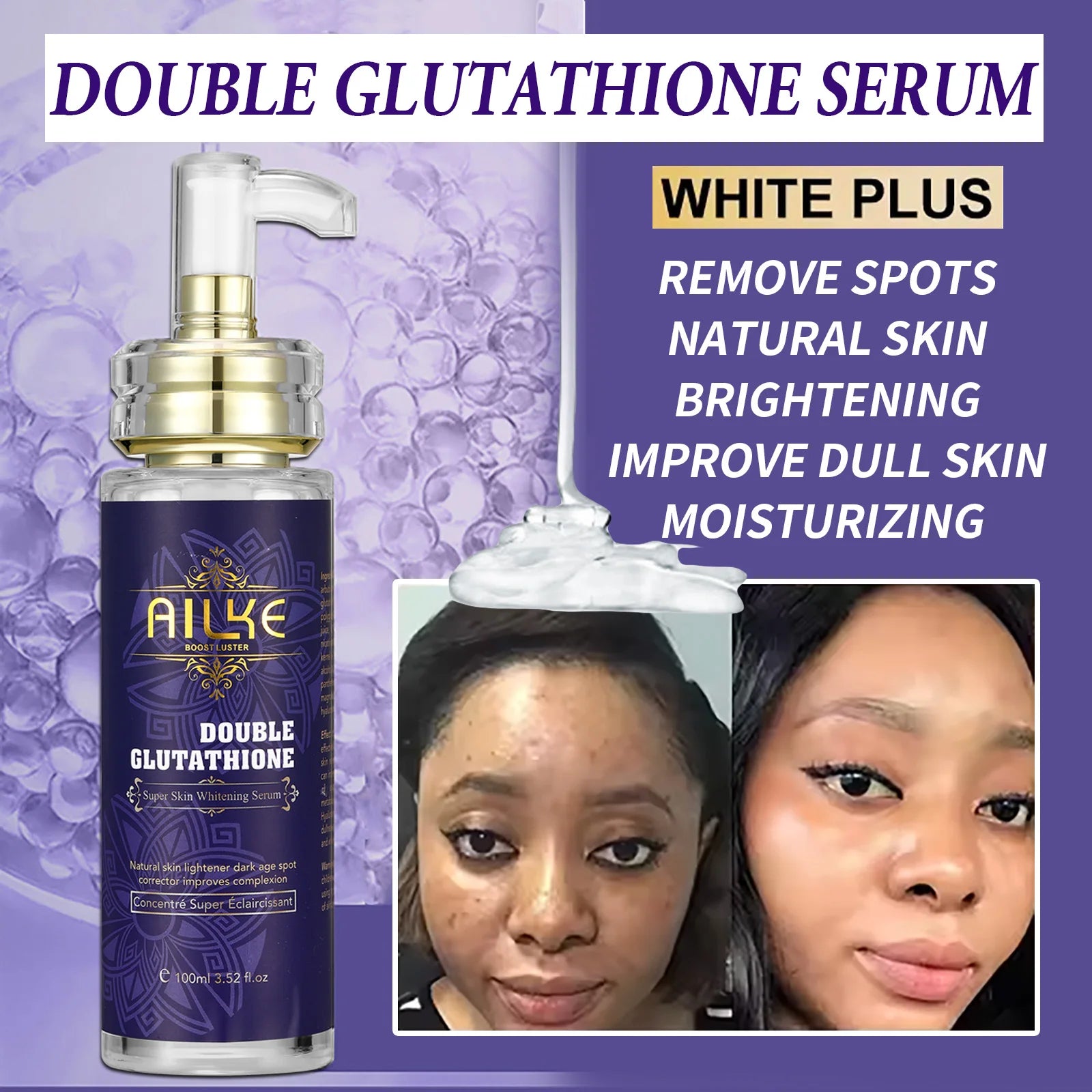 AILKE Glutationa 5 em 1 Kit de cuidados com a pele feminina, com loção corporal, soro, creme para remoção de manchas escuras, creme corporal, sabonete iluminador