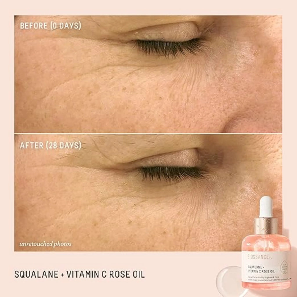 Óleo Facial Avançado de Squalano + Vitamina C com Rosa - Sérum Iluminador, Firmador e Hidratante para Todos os Tipos de Pele
