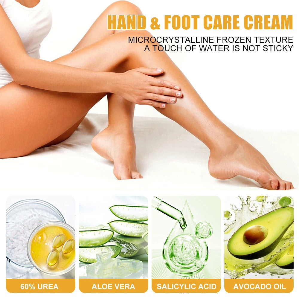Creme Ultra-Hidratante para Pés com 60% de Ureia, Suaviza Pés Secos e Rachados, Exfoliação Suave, Creme Hidratante para Cuidados com os Pés