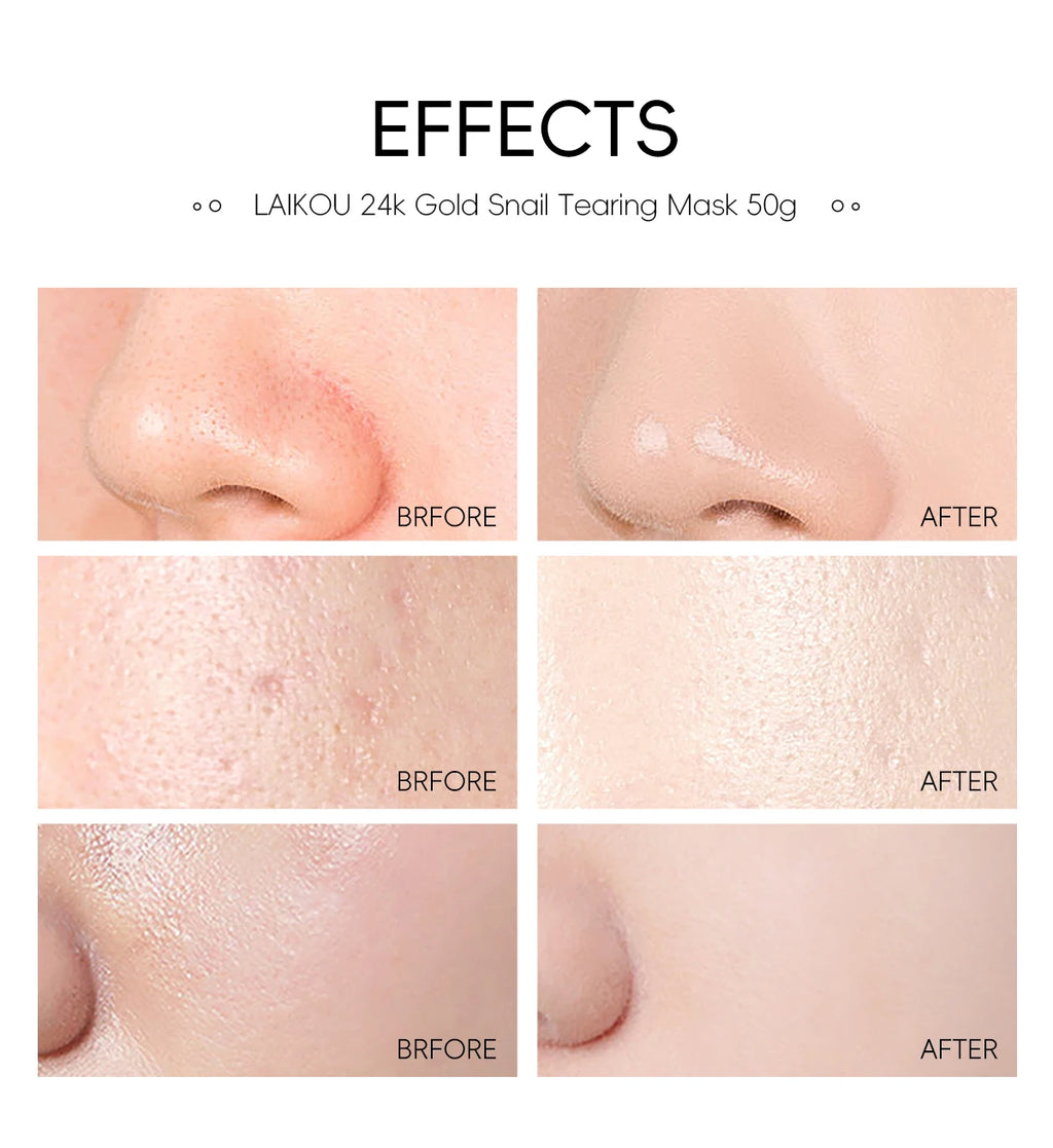 Laikou 24k ouro caracol peel-off máscara 3 pçs limpeza profunda poros aperto remoção de cravo desintoxicante tratamento facial 50g