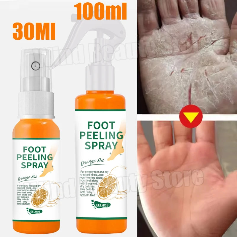Creme anti-rachadura para pés, spray de ervas para rachaduras no calcanhar, produtos de reparo, esfoliação, remoção de pele morta, suavização, hidratação, cuidados suaves